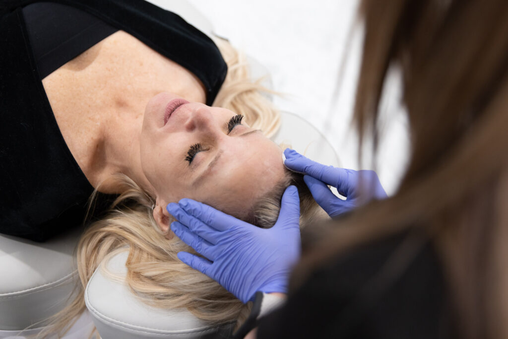 Chemical Peel Treatment
