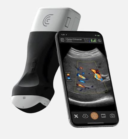 ultrasound filler dissolving New Canaan